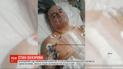 Девять месяцев на грани жизни и смерти: "суд" в Крыму выпустил из СИЗО Эдема Бекирова