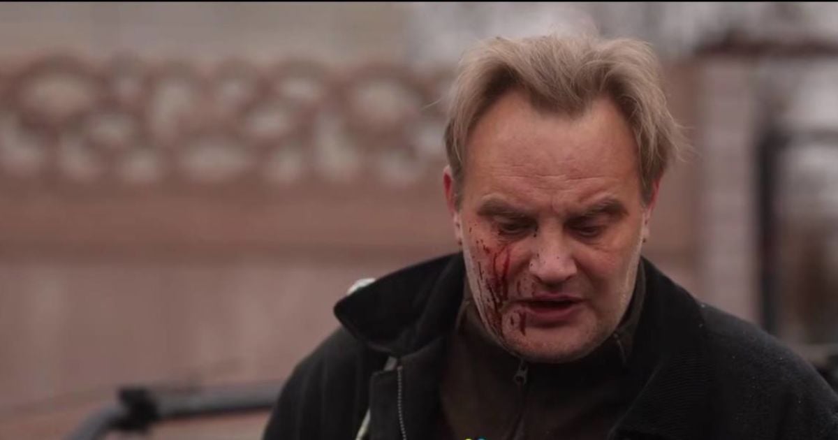 Постраждалий чоловік внаслідок російського обстрілу