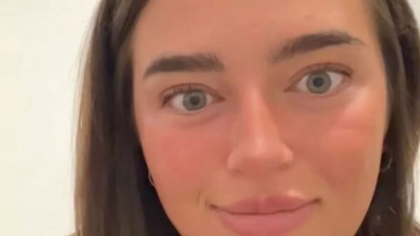 Еліс Мандрі / Фото: alicemandry1/ CATERS NEWS