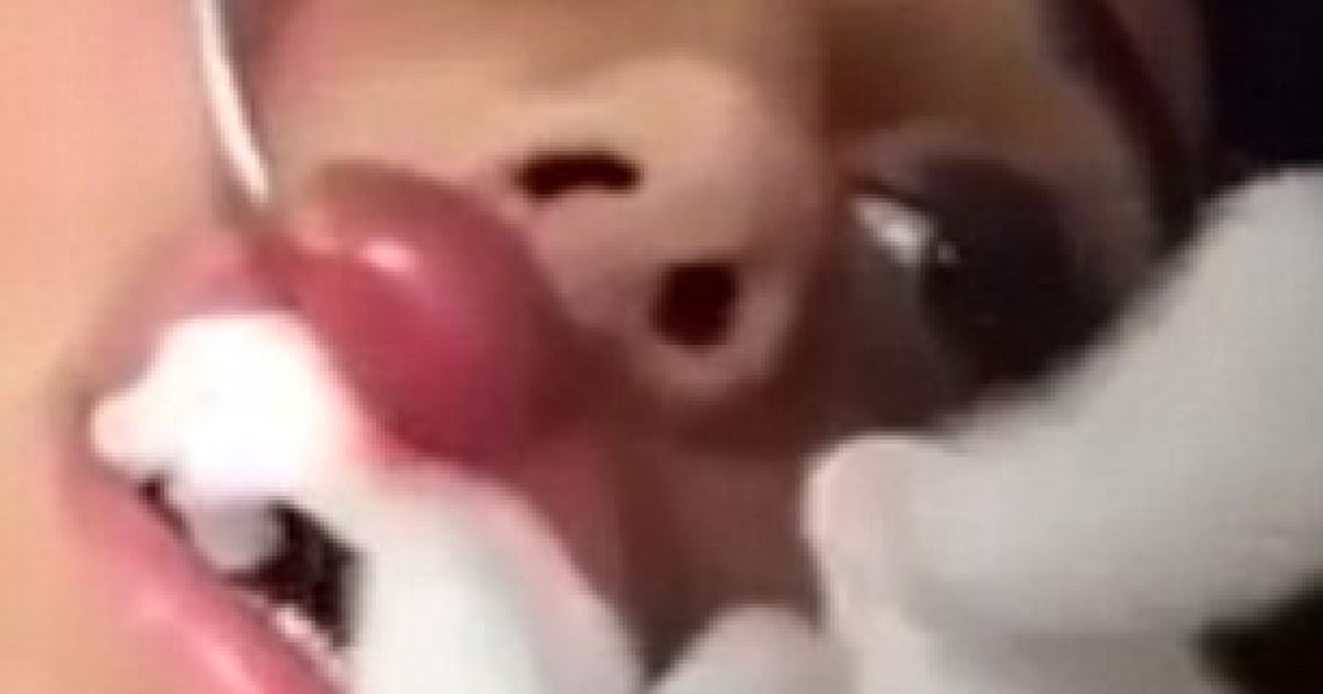 Врачу пришлось доставать червя из губы женщины