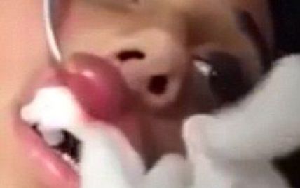 Юзеров поразило жуткое видео, на котором хирург удаляет из губы женщины живого червя