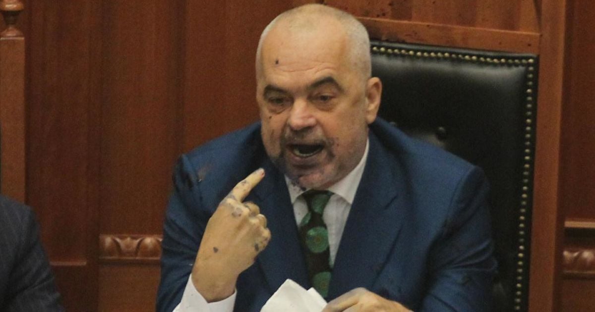 В албанском парламенте депутат брызнул чернилами в лицо премьер-министра