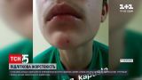 В Запорізькій області 6 підлітків кілька годин били 9-класника, принижували та вимагали гроші | Новини України