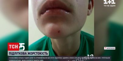 В Запорізькій області 6 підлітків кілька годин били 9-класника, принижували та вимагали гроші | Новини України