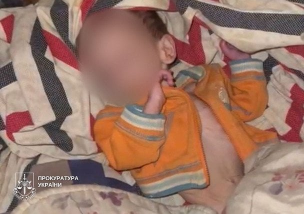 У дитини виявили низку проблем зі здоров’ям через тривалу відсутність годування / Фото: Київська міська прокуратура