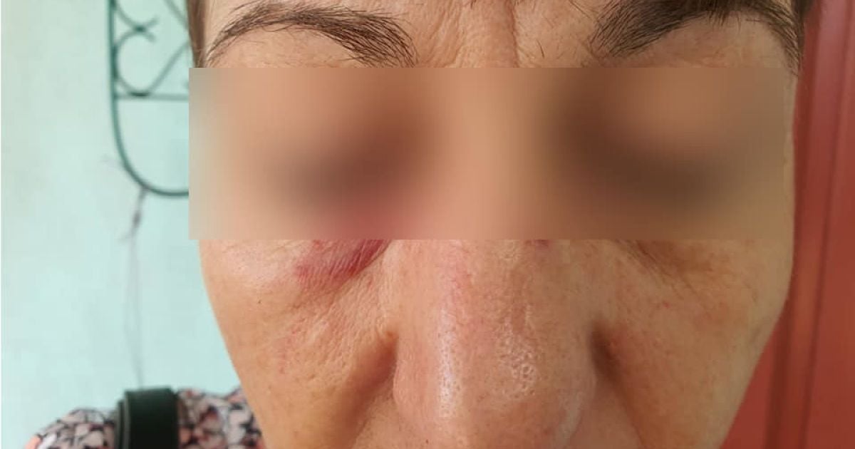 В Сумах пассажирка жестоко избила кондуктора из-за маски: фото