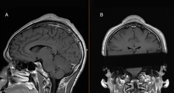 Наслідки брейкдансу / Фото: BMJ Case Reports