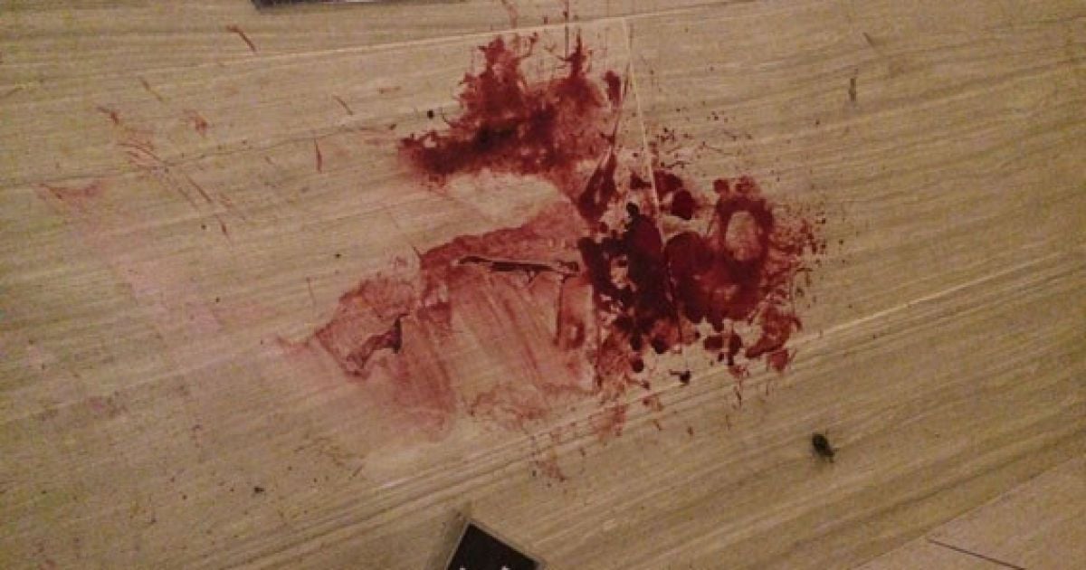 На Рівненщині невідомі катували подружжя у власному домі та вкрали 19 тис. доларів