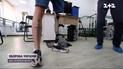 Реабилитация Героев – как современные протезы творят чудеса и поддерживают раненых