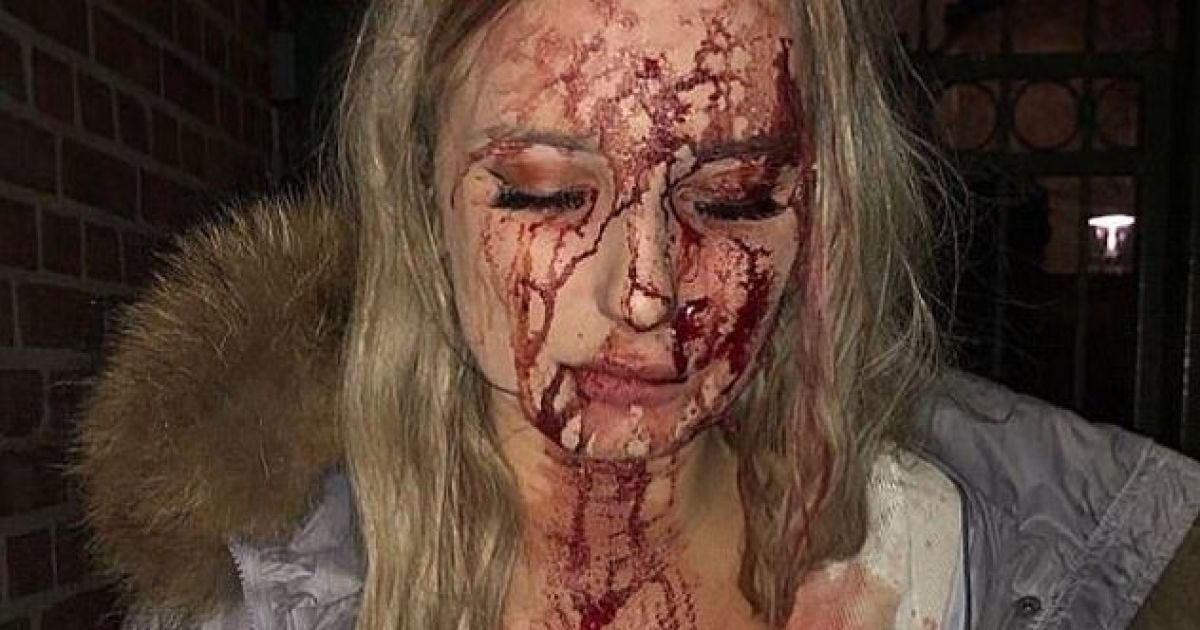 У Швеції чоловік розбив пляшку об голову дівчини, перед цим залізши руками між її ногами