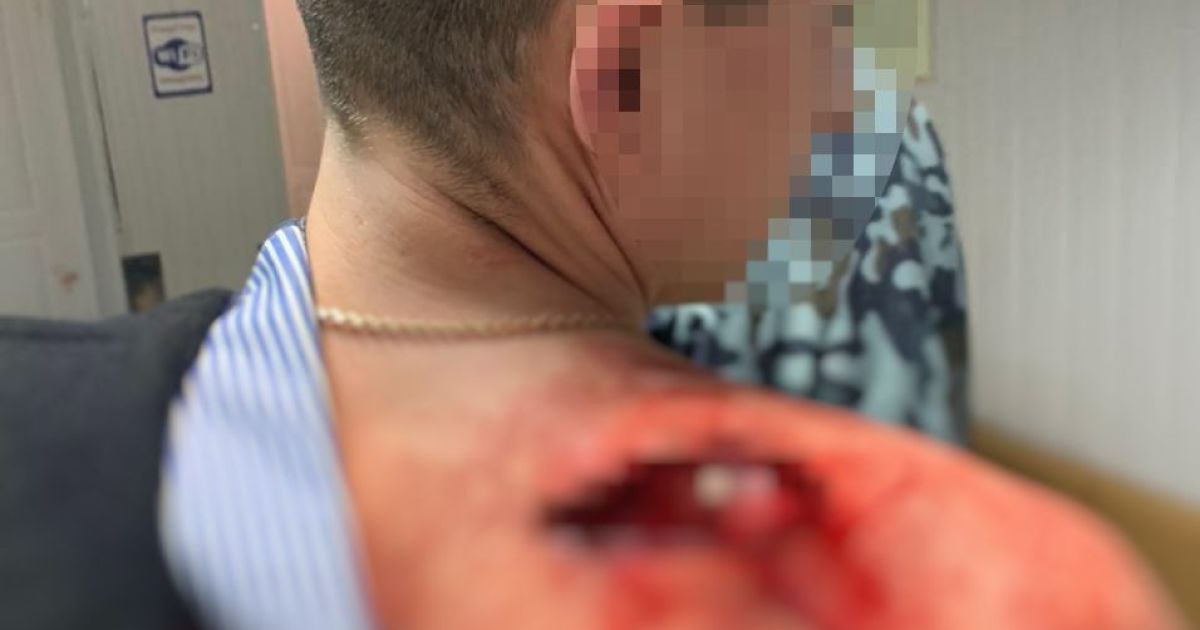 В Днепре пьяный полицейский стрелял в начальника службы охраны: пострадавший в больнице с тяжелыми травмами