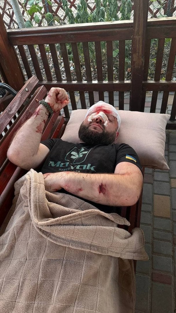 У Затоці побили військового Сергія Пігуру після прохання вимкнути російську музику  / © Цензор.нет