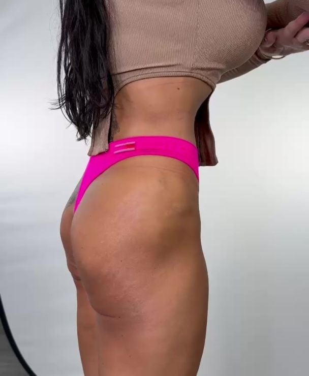 Бразильская подтяжка ягодиц / Фото: Dr Ducu Clinics