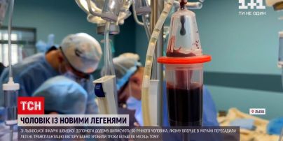 Новости Львова: из больницы домой уйдет 56-летний мужчина, которому впервые в Украине пересадили легкие