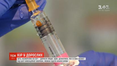 Как взрослому человеку узнать, есть ли у него защита от кори