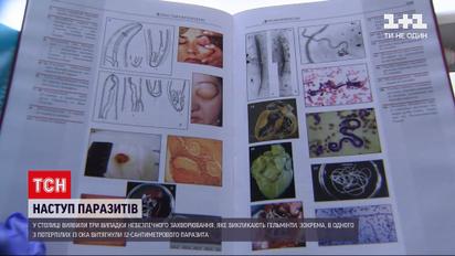 Новости Украины: в Киеве из глаза пациента извлекли 12-сантиметрового гельминта