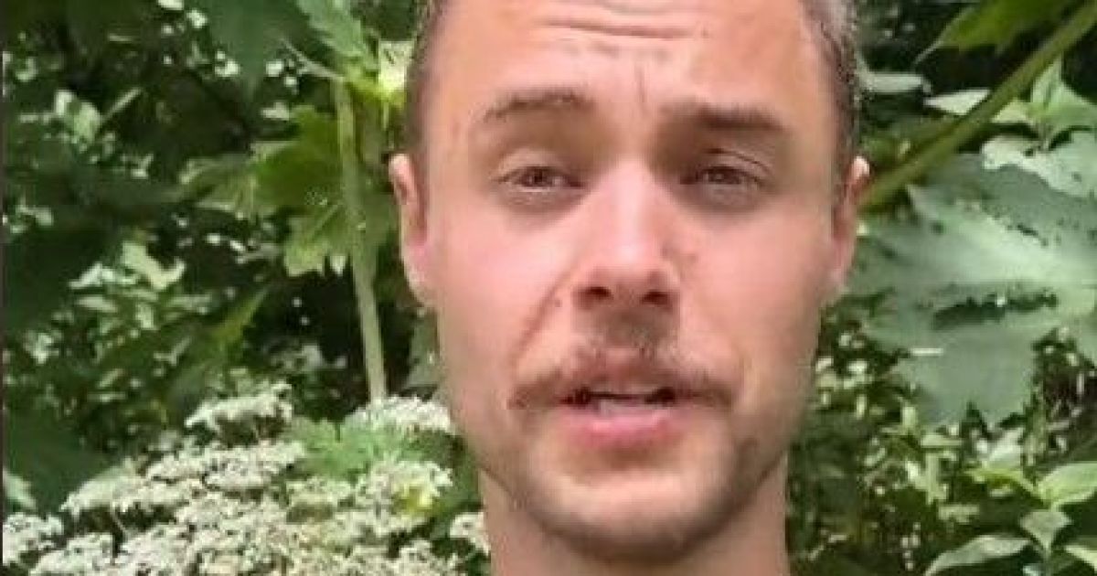 Мужчина показал последствия ожогов борщевиком