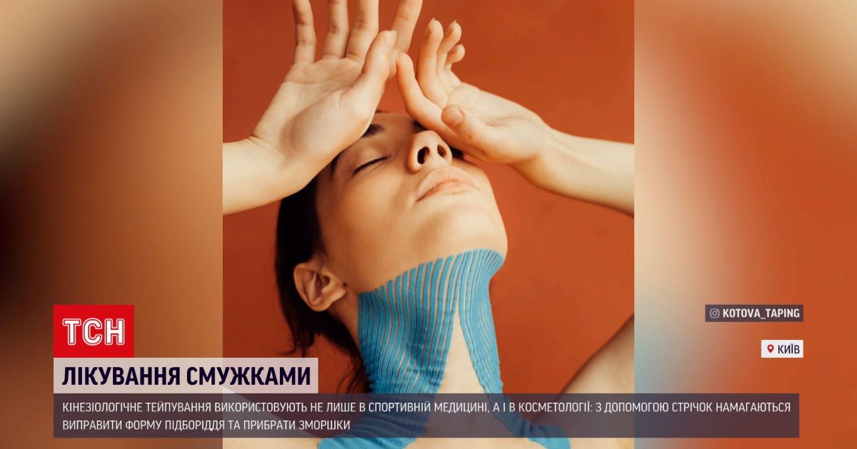 Тренд или действенный метод: можно ли похудеть с помощью тейпирования