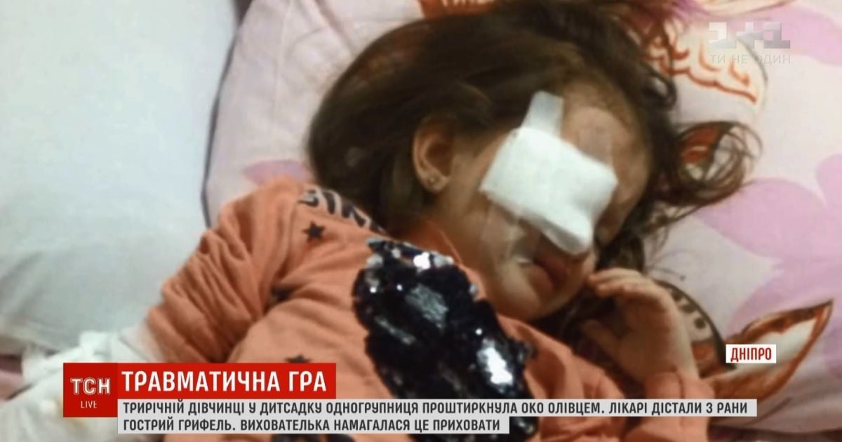 Фиолетовые слезы: в Днепре воспитательница проглядела тяжелую травму 3-летнего ребенка