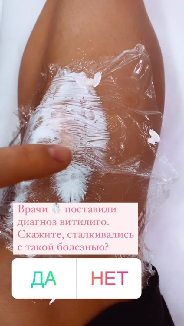  / © instagram.com/reginatodorenko