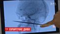 В США 30-сантиметровый шампур пробил мальчику голову
