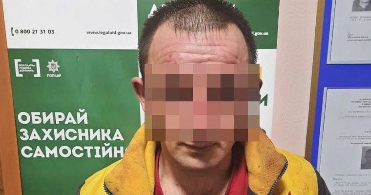 В Николаеве мужчина облил химической жидкостью жену и детей: пострадавшие с ожогами в больнице