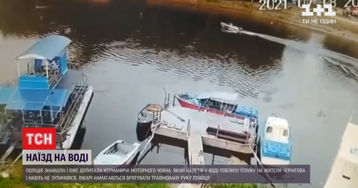 Покорежил руку пловца моторной лодкой и уехал: в Чернигове нашли горе-водителя
