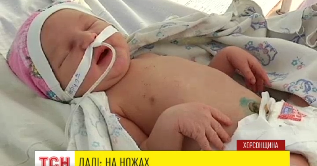 На Херсонщине мать едва не убила своего ребенка