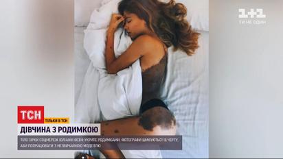 Как родинки на теле помогли одесситке стать звездой Instagram