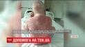 Полжизни с болезнью: 5-летний Владик из Хмельнитчины срочно нуждается в деньгах на лечение