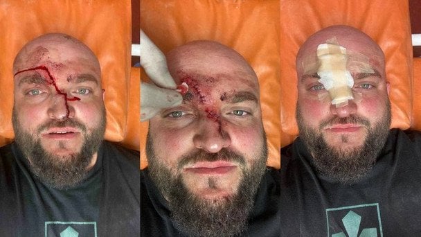 У Затоці побили військового Сергія Пігуру після прохання вимкнути російську музику  / © Цензор.нет