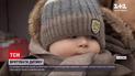 На Буковині збирають кошти на порятунок 9-місячного хлопчика