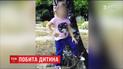 4-летняя девочка, подвергшаяся дома тяжелым травмам, до сих пор на грани жизни и смерти