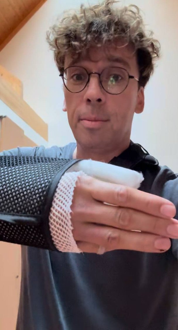 Максим Галкін після ДТП / © instagram.com/maxgalkinru