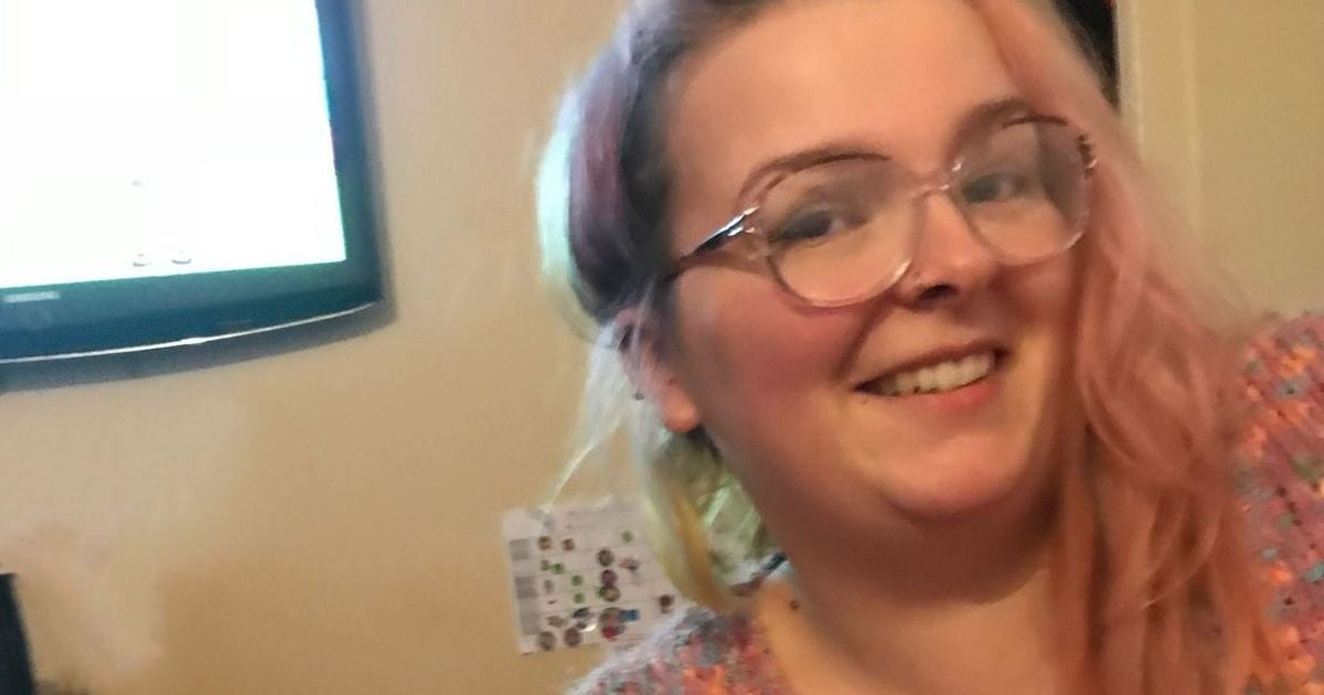 Мама троих детей ошарашила результатом серии пластических операций: фото до и после