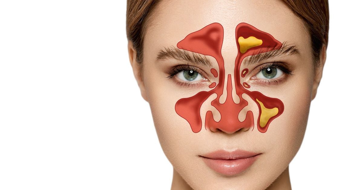 Гайморит і запалення носових пазух