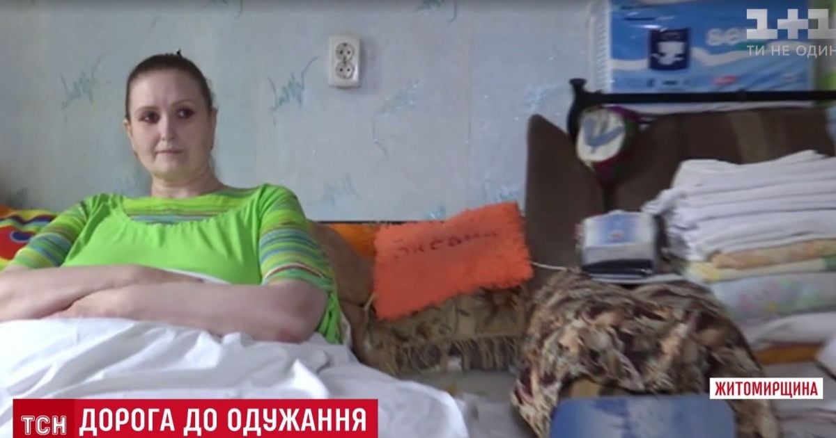 Унікальна 350-кілограмова українка потребує допомоги в лікуванні слоновості ніг