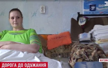 Уникальная 350-килограммовая украинка нуждается в помощи в лечении слоновости ног