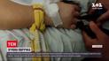 Травматична каблучка: запорізькі надзвичайники врятували жінку від ампутації