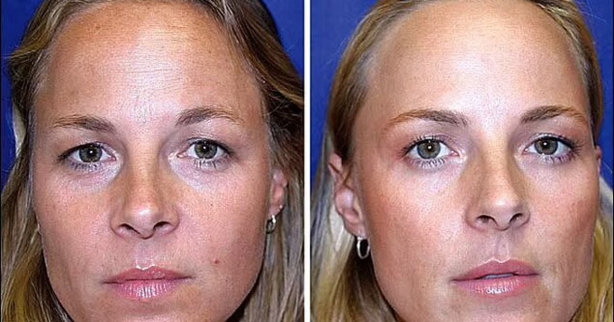 Пискадағы микрокамерамен порно көру