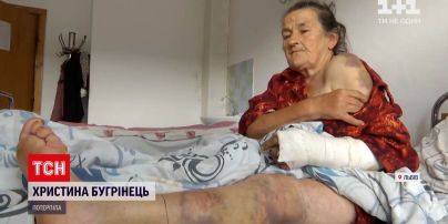 Новини України: 73-річна жінка звинувачує старосту села в побитті через корову