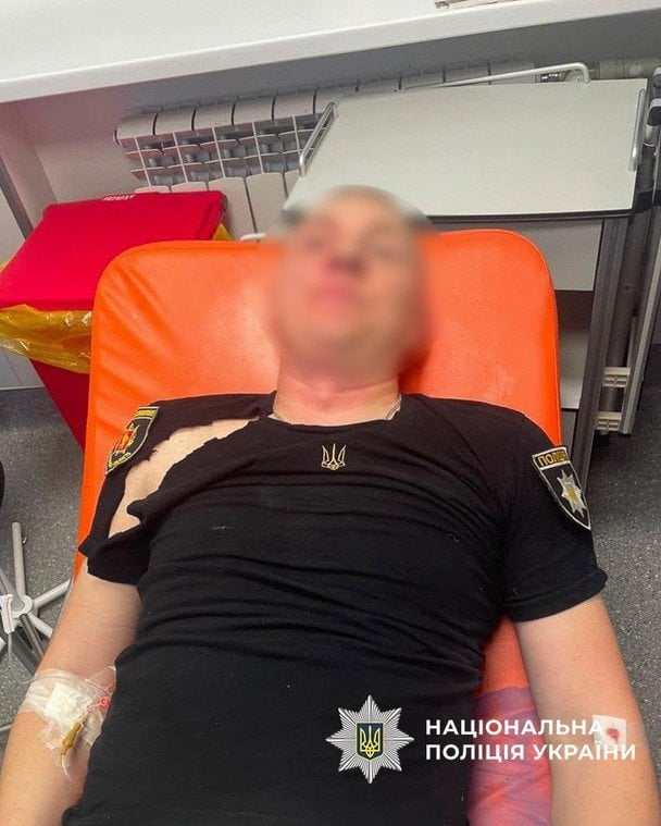 Троє правоохоронців отримали ножові поранення. / © Національна поліція України
