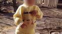 Чуда не случилось: в Днепре умер 2-летний мальчик, которого ножом порезал отчим