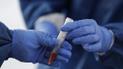 В Україні дозволили не робити ПЛР-тест на коронавірус: кому і в яких випадках
