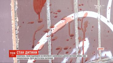 Медики рассказали о состоянии ребенка, которому взрывом гранаты оторвало кисть руки