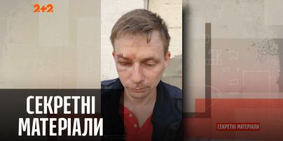 Криминальный авторитет травмировал мужчину за то, что он не пропустил его авто – "Секретные материалы"