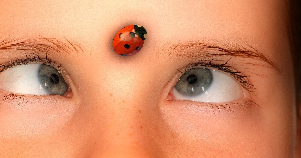 Косоокість