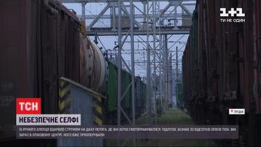 У Луцьку підліток отримав 30 % опіків тіла, коли хотів зробити селфі