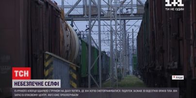 В Луцке подросток получил 30% ожогов тела, когда хотел сделать селфи