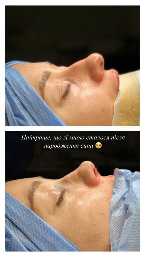 Катерина Реп'яхова / © instagram.com/repyahovakate